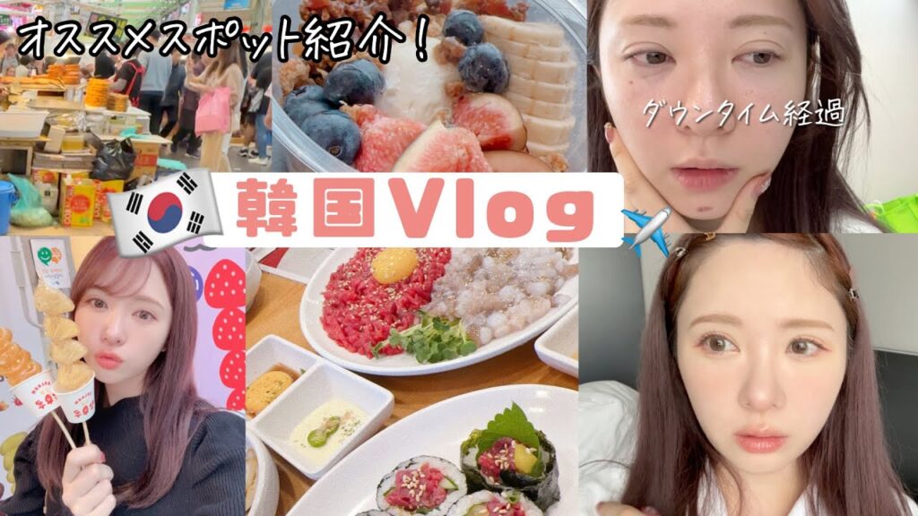 【韓国Vlog】美容課金＆爆食の旅！#2 ご飯/買い物/カフェ/首肩ボトックス/ダウンタイム経過も 【韓国旅行】