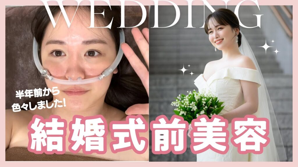 【本気美容】結婚式の半年前から綺麗になる為、本気出しました...♡！！