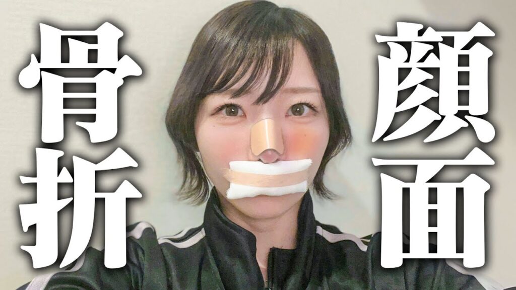 顔面骨折…手術しました。