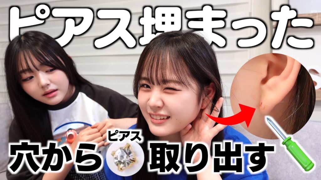 ピアスの飾り部分がピアスの穴から耳たぶの中に入った‥自力で取り除く?病院だったら何科へ行くん? ピアスの飾り部分がピアスの穴から耳たぶの中に入った‥自力で取り除く?病院だったら何科へ行くん?