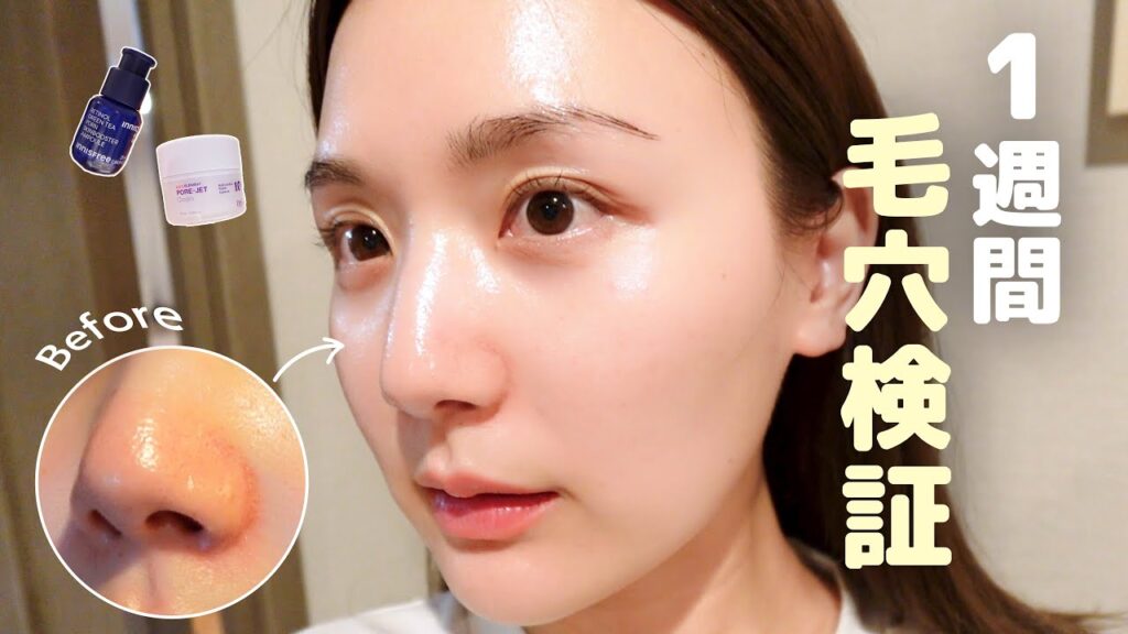 【検証】実際ひよんの毛穴ってどうなの？肌診断の結果を元に徹底ケアした7日間！本当に効果があったアイテム紹介🫧【スキンケアvlog】