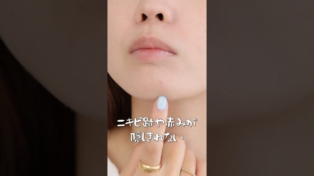 【ニキビ跡が浮いてくる…】ならこの方法がおすすめ！