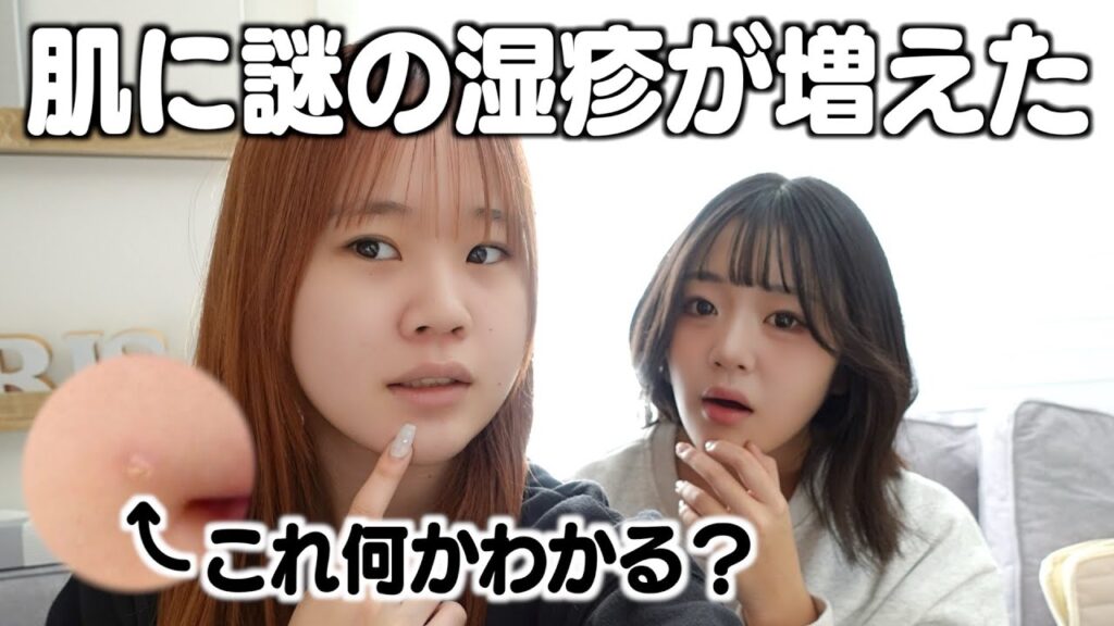 姉の顔にはじめて見る湿疹ができて‥さらに増えてきたので皮膚科へ行こうか悩んでいます。