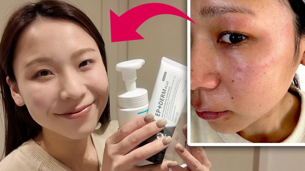 【絶望肌から大逆転】守りのスキンケア紹介|乾燥肌・敏感肌・アトピー 【絶望肌から大逆転】守りのスキンケア紹介|乾燥肌・敏感肌・アトピー