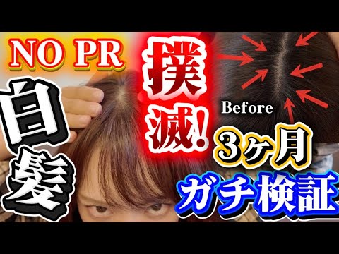 関根理紗: 【白髪日記】市販品だけで3ヶ月、白髪撲滅検証したけどすごかった! 【白髪日記】市販品だけで3ヶ月、白髪撲滅検証したけどすごかった!